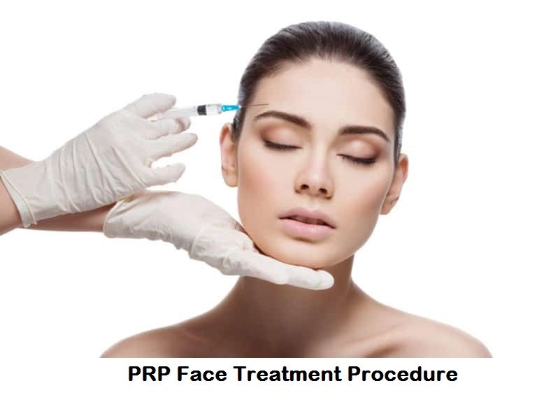 How prp face treatment in Gurgaon works